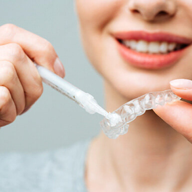 A young woman trying at-home teeth whitening
