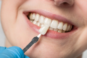 Close up of dentist comparing a porcelain veneer to patient’s teeth